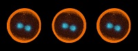 Sea urchin embryo 04