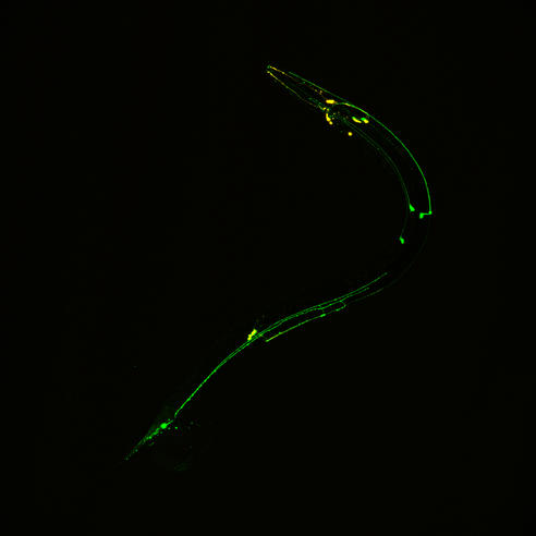 Neural circuits in worms similar to those in humans