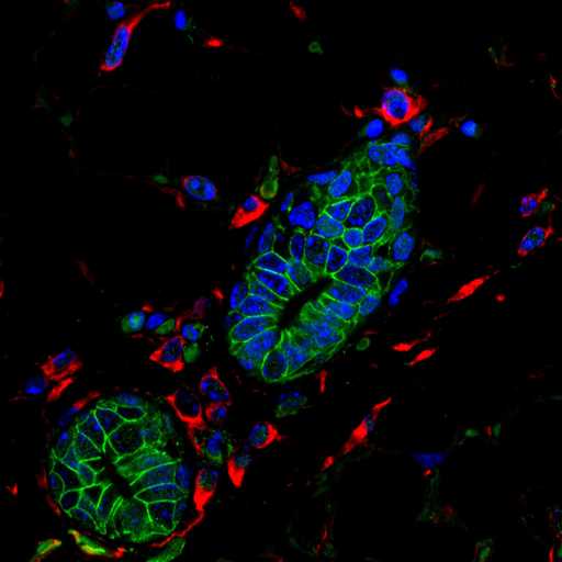 Mouse mammary cells lacking anti-cancer protein