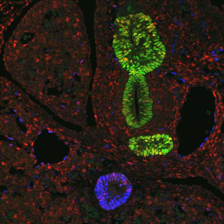 Transcription factor Sox17 controls embryonic development of certain internal organs
