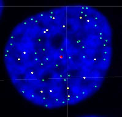 Telomeres on outer edge of nucleus during cell division