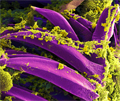 In this photo bubonic plague bacteria (yellow) are shown in the digestive system of a rat flea (purple). Carried by rodents and spread by fleas, the bubonic plague killed a third of Europeans in the mid-14th century. Today, it is still active in Africa, Asia and the Americas, with as many as 2,000 people infected worldwide each year. If caught early, bubonic plague can be treated with antibiotics. Photo credit: B. Joseph Hinnebusch, Elizabeth Fischer and Austin Athman, National Institute of Allergy and Infectious Diseases, National Institutes of Health