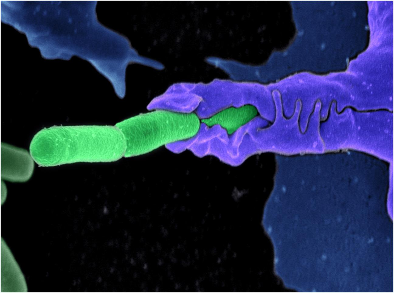 Anthrax bacteria (green) being swallowed by an immune system cell