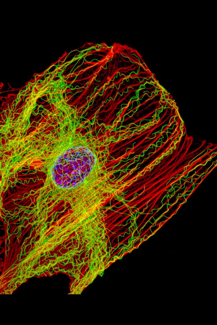 Cells keep their shape with actin filaments and microtubules
