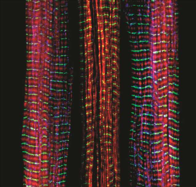 Three muscle fibers; the middle has a defect found in some neuromuscular diseases