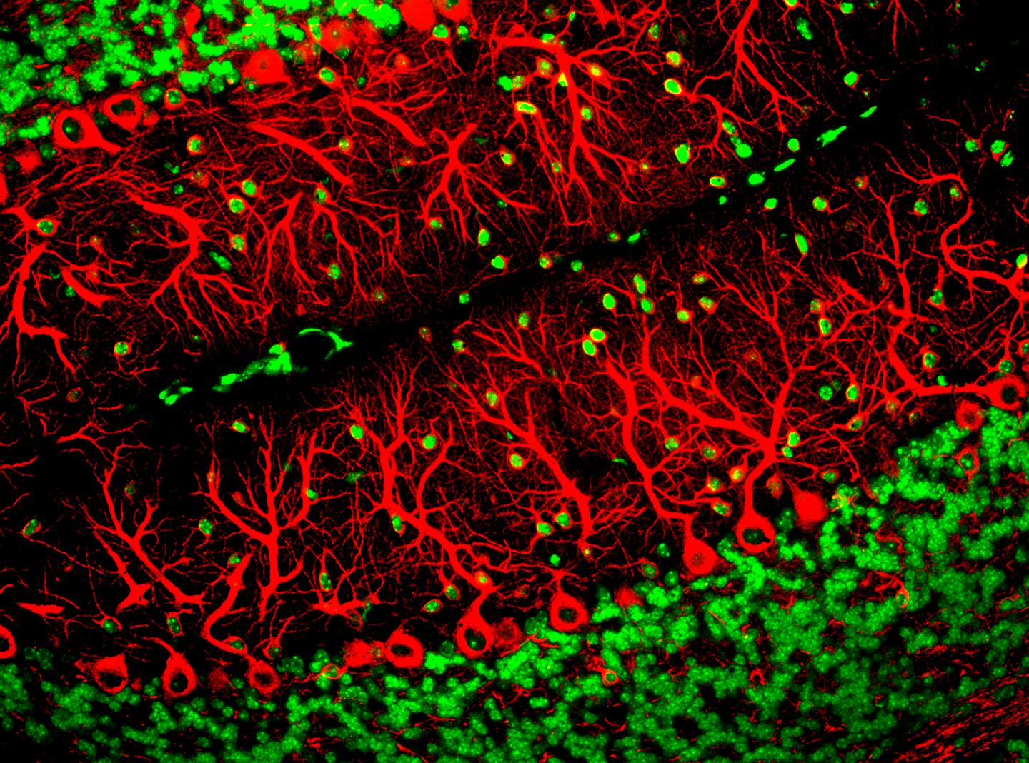 Purkinje cells are one of the main cell types in the brain
