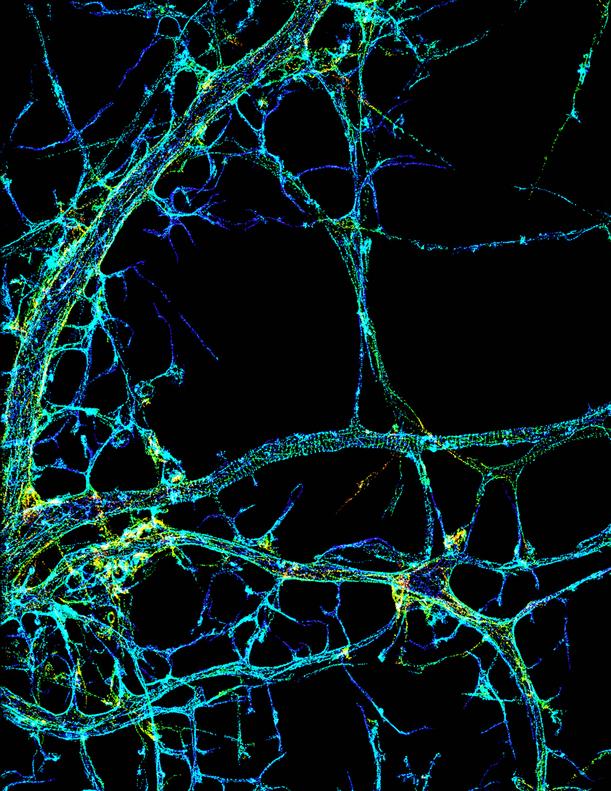STORM image of axonal cytoskeleton