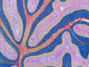 Mouse cerebellum in pink and blue