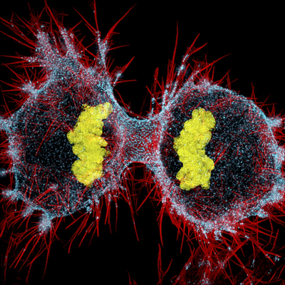 HeLa cell undergoing division into two daughter cells