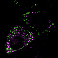 Stress Response in Cells 