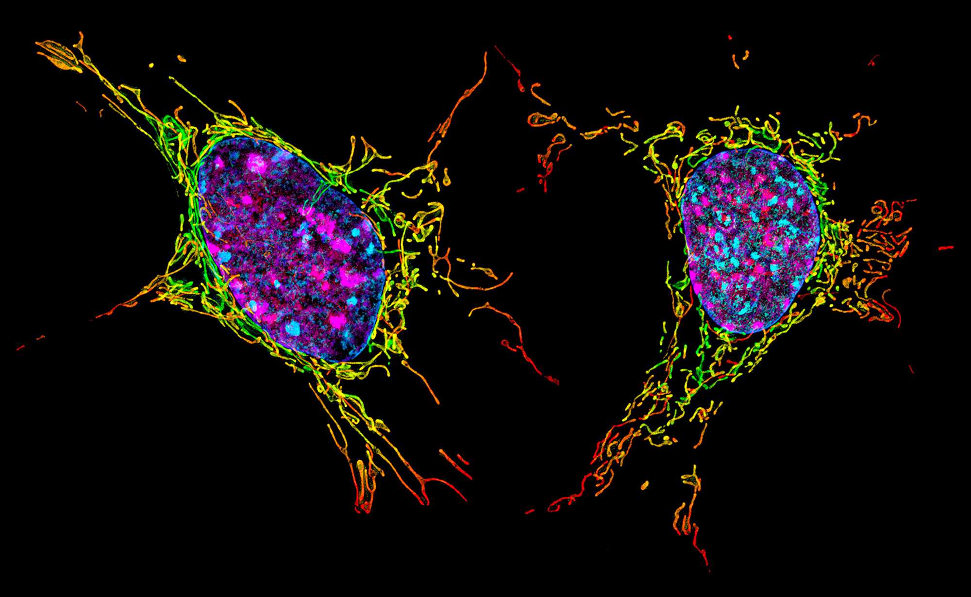 Two mouse fibroblast cells