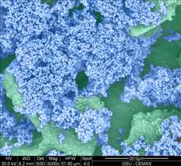 Staphylococcus aureus aggregates on microstructured titanium surface