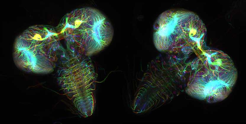 Fruit fly larvae brains showing tubulin