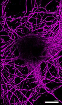 Microtubules in hippocampal neurons