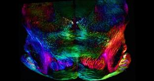 Mouse brain slice showing nerve cells