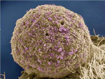 HIV Infected Cell