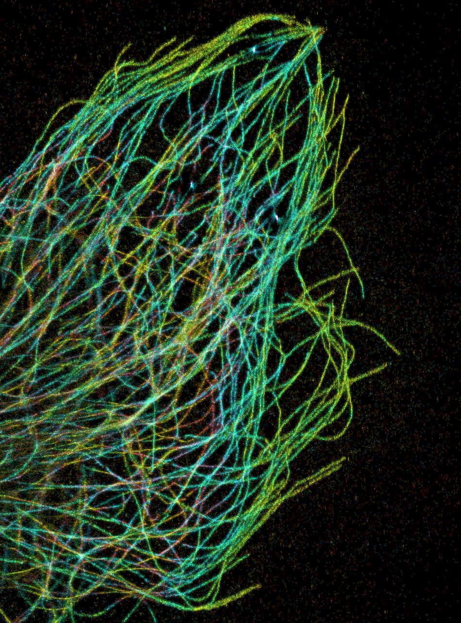 Tiny strands of tubulin, a protein in a cell's skeleton