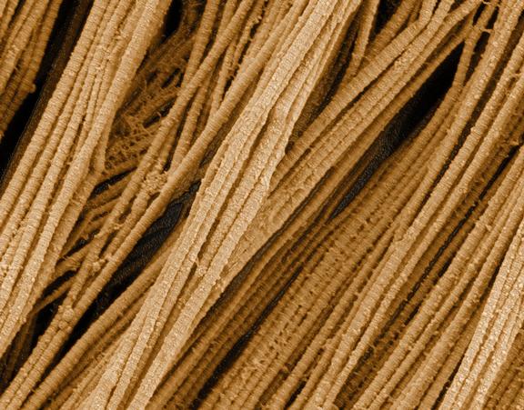 Scanning electron microscopy of collagen fibers