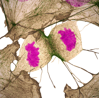 Human fibroblast undergoing cell division