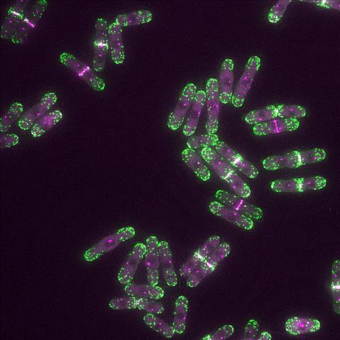 Yeast cells with endocytic actin patches